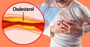 đối tượng dễ bị bệnh mỡ máu