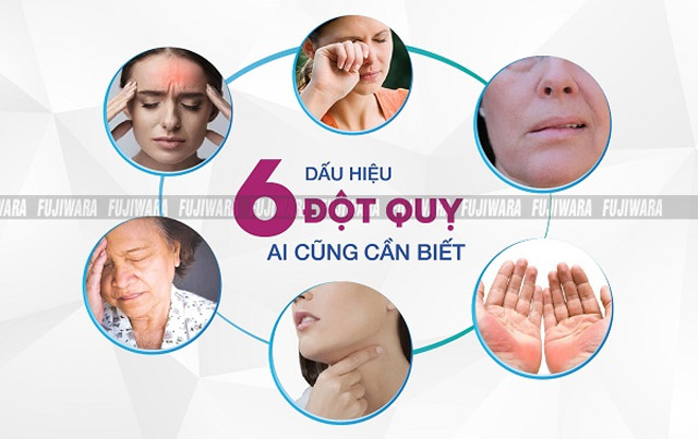 Dấu hiệu nhận biết đột quỵ