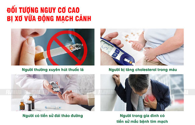 Đối tượng có nguy cơ mắc phải bệnh xơ vữa động mạch
