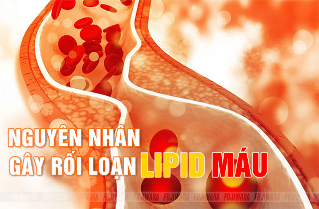 Nguyên nhân gây rối loạn lipid máu