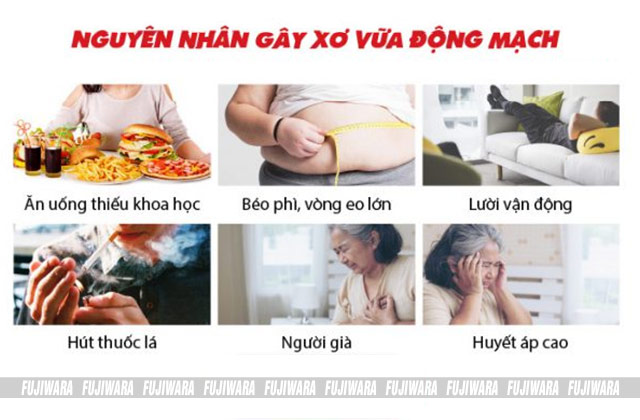 Nguyên nhân gây xơ vữa động mạch