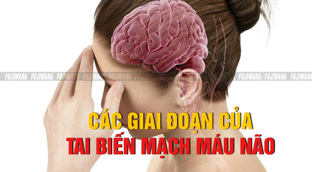 Các giai đoạn của bệnh tai biến mạch máu não
